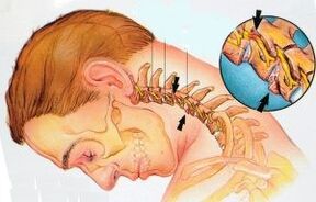 Il dipartimento cervicale