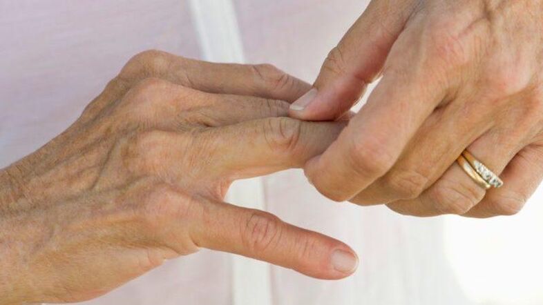 In ciò che le malattie fanno male le articolazioni delle dita
