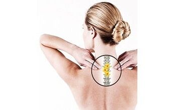 osteocondrosi cervicale in una donna