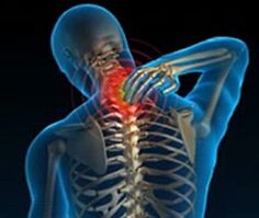 osteocondrosi del rachide cervicale